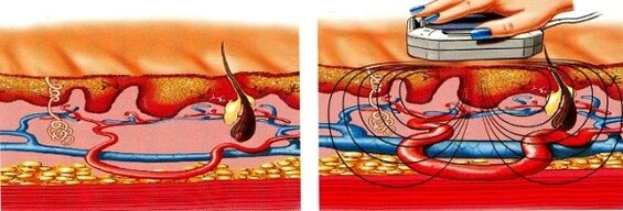 dacă ți se amorțesc picioarele